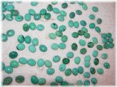 Turquoise Oval Cabochon Lot