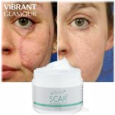 ScarFade Gel for Acne and Stretch Marks