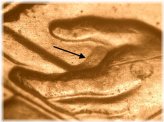 The Unique Lincoln Cent with Notable Doubling