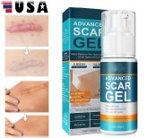 ScarFade Renewal Gel
