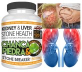 StoneCrush Herbal Capsules