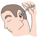 Spiral Tip Ear Cleaning Kit