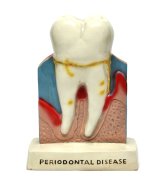 Dental Anatomy Teaching Model