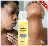 Radiant Glow Renewal Serum