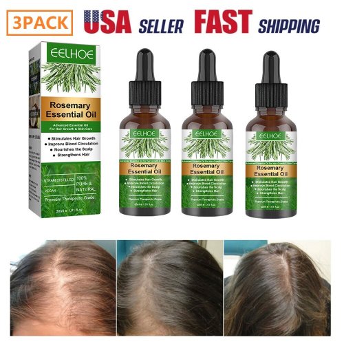 Rosemary Renewal Hair Therapy Set
