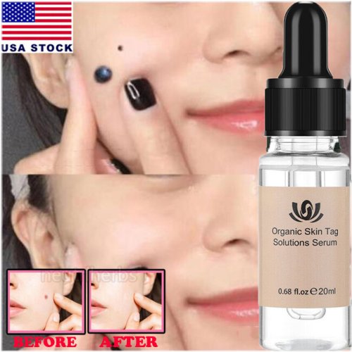 Clear Complexion Serum
