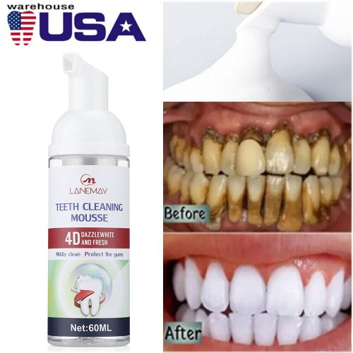 Minty White Foam Cleanser