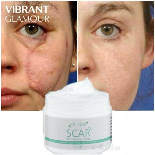 ScarFade Gel for Acne and Stretch Marks