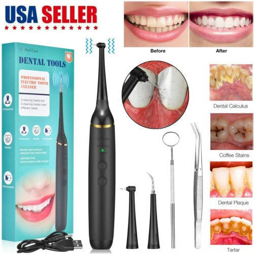 PureSmile Teeth Brightening Kit