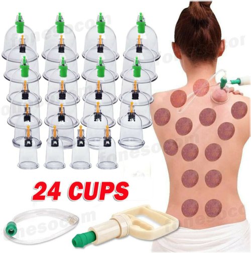 Cupping Therapy Set