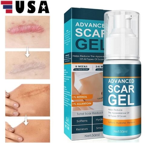 ScarFade Renewal Gel