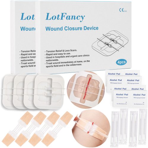 Rapid Wound Closure Kit