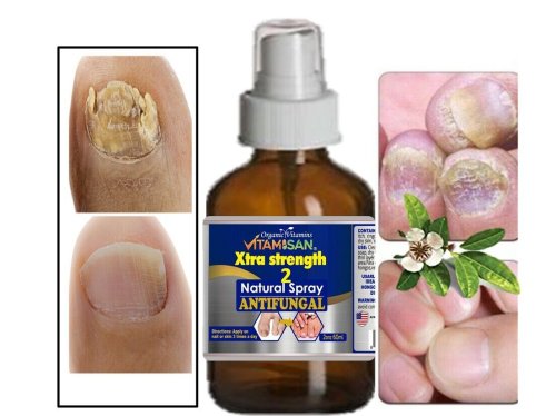 FungiShield Nail Treatment