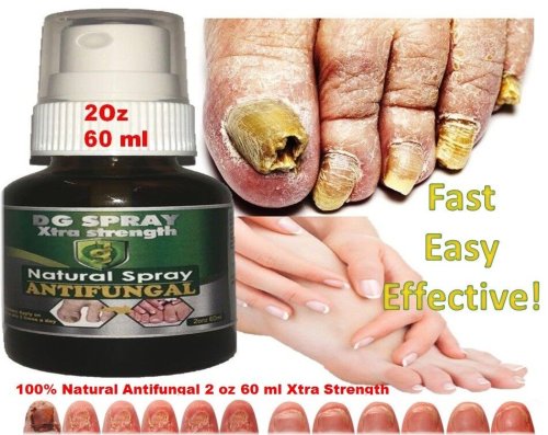 Healthy Feet Cream