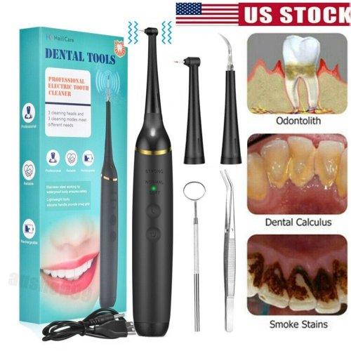 DentaSonic ProCleaner