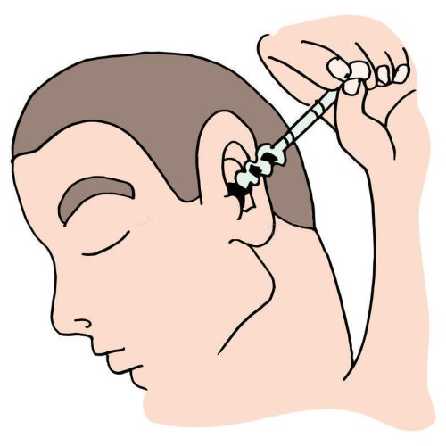 Spiral Tip Ear Cleaning Kit