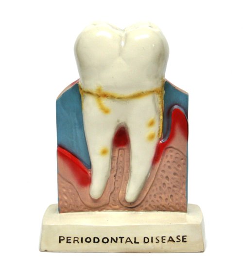 Dental Anatomy Teaching Model