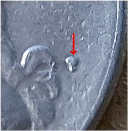 1984 P Washington Quarter Filled Mint Mark & Grease Struck Error